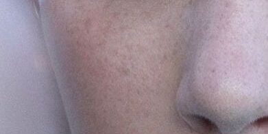 eye eye